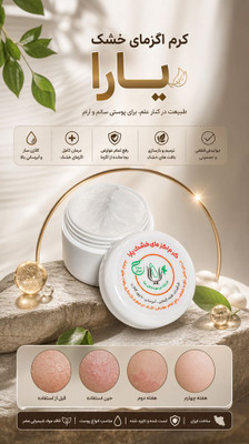 کرم اصلی  اگزمای خشک یارا