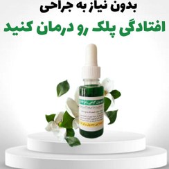 مرهم افتادگی پلک لارا*بدون نیاز به جراحی افتادگی پلکت رو درمان کن