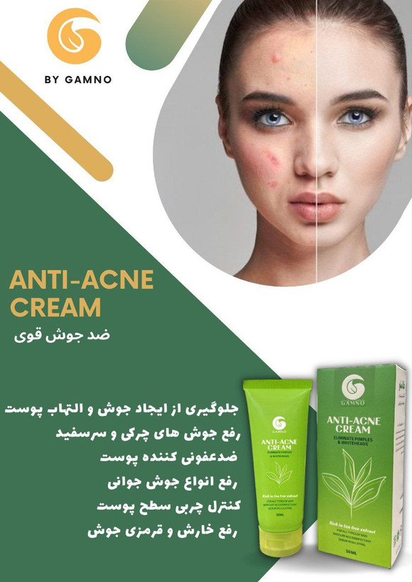 کرم آنتی اکنه گامنو *ضدجوش تخصصی
