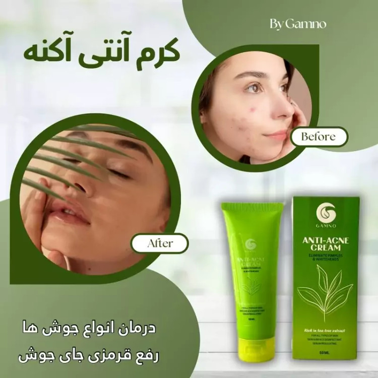 کرم آنتی اکنه گامنو *ضدجوش تخصصی